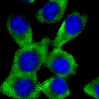 c-FER antibody