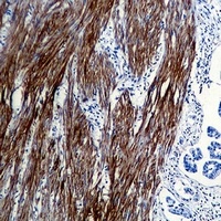 Alpha-actin-1 Mouse Monoclonal Antibody