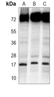 SUMO1 Antibody [KO/KD Validated]