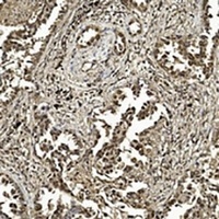 Anti-SUMO1 Antibody