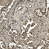 SUMO1 antibody