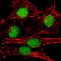 SUMO1 antibody