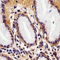 Anti-Rac 1 Antibody
