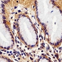 Rac 1 antibody