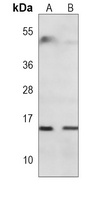 Rbx1 Antibody [KO/KD Validated]
