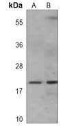 VILIP-1 Mouse Monoclonal Antibody