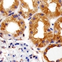 RPS6 antibody