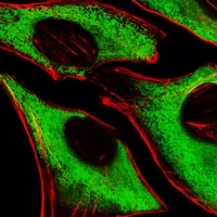 Anti-RPS6 Antibody