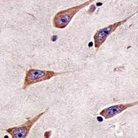 Anti-RAB11A Antibody