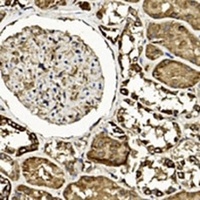 TGF beta 2 antibody