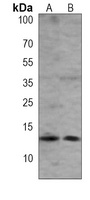 Beta 2 Microglobulin Mouse Monoclonal Antibody