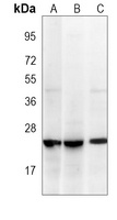 RhoA Mouse Monoclonal Antibody