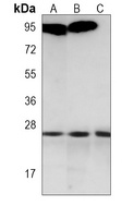 RAB14 Antibody