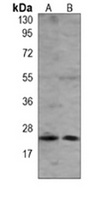 RAB5B Antibody