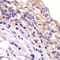 Anti-BID Antibody