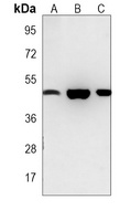 Adenosine Kinase Mouse Monoclonal Antibody