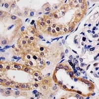 Adenosine Kinase Mouse Monoclonal Antibody