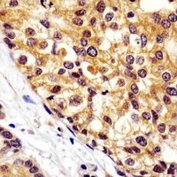 Anti-VCP Antibody