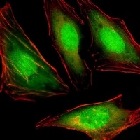 Anti-VCP Antibody