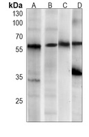 USP14 Antibody