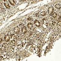 Anti-METAP1 Antibody