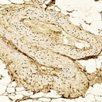 Anti-Hexokinase 2 Antibody