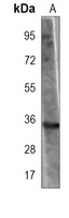 BRCA2 Mouse Monoclonal Antibody