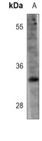 HNMT Mouse Monoclonal Antibody