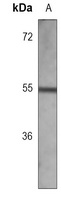 p57 Kip2 Antibody