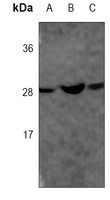 CDX1 Mouse Monoclonal Antibody