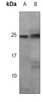 p27 Kip1 Mouse Monoclonal Antibody