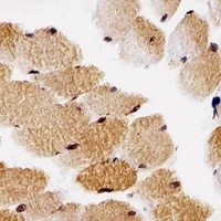 p27 Kip1 Mouse Monoclonal Antibody
