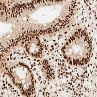 Anti-MSH2 Antibody