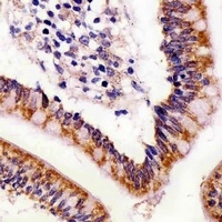 Anti-ABL2 Antibody