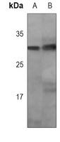 Caspase 3 Mouse Monoclonal Antibody