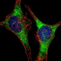 Anti-GlyRS Antibody