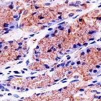 Anti-Prohibitin Antibody