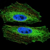 Anti-BMI1 Antibody