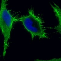 Beta-catenin Mouse Monoclonal Antibody