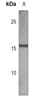 CDA Mouse Monoclonal Antibody