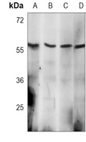 AKT2 Antibody