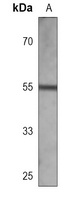 AKT Mouse Monoclonal Antibody
