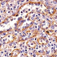Anti-PPP2R1B Antibody