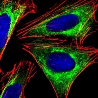Anti-PPP2R1B Antibody