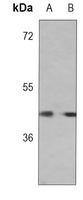 SCCA1 Mouse Monoclonal Antibody