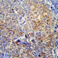 Anti-HSP47 Antibody