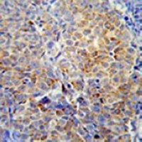 HSP47 antibody