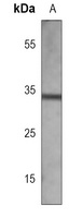 EPHB2 Antibody