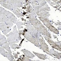 EPHB2 Antibody