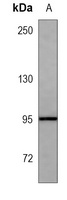 CD30 Mouse Monoclonal Antibody